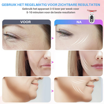 Dermawave Pro™ |Jouw Ultieme Oplossing voor een Stralende, Strakke en Jonger Uitziende Huid